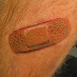 Tattoo of bandaid