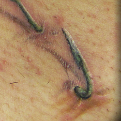 Tattoo of fidh hook in skin